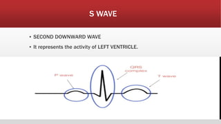 S WAVE
▪ SECOND DOWNWARD WAVE
▪ It represents the activity of LEFT VENTRICLE.
 