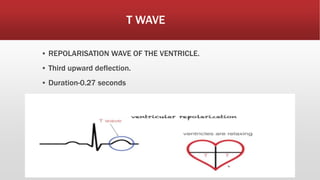 T WAVE
▪ REPOLARISATION WAVE OF THE VENTRICLE.
▪ Third upward deflection.
▪ Duration-0.27 seconds
 