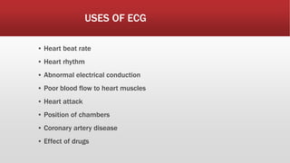 USES OF ECG
▪ Heart beat rate
▪ Heart rhythm
▪ Abnormal electrical conduction
▪ Poor blood flow to heart muscles
▪ Heart attack
▪ Position of chambers
▪ Coronary artery disease
▪ Effect of drugs
 