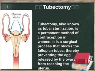 Tubesctomy Methods FAMILY PLANING METHOD AND PROGRAMME IN BRIEF | PPTX