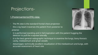 Share IMAGING PROTOCOL OF THORACIC CAVITY.pptx