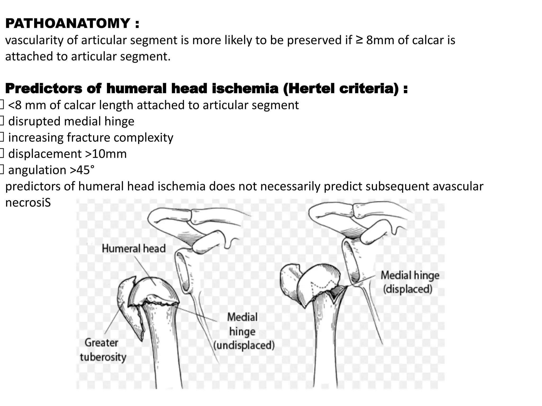 PATHOANATOMY :
vascularity of articular segment is more likely to be preserved if ≥ 8mm of calcar is
attached to articular segment.
Predictors of humeral head ischemia (Hertel criteria) :
<8 mm of calcar length attached to articular segment
disrupted medial hinge
increasing fracture complexity
displacement >10mm
angulation >45°
predictors of humeral head ischemia does not necessarily predict subsequent avascular
necrosiS
 