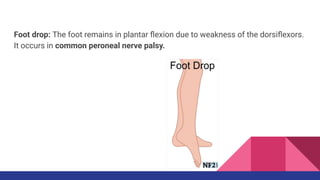 Share Peripheral nerve injuries ppt download | PDF