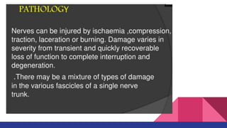 Share Peripheral nerve injuries ppt download | PDF