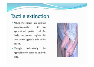 Examination of sensory system | PDF