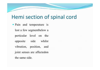 Anterior spinal syndrome
 Loss of pain, temperature
and touch below a level
on both sides with
on both sides with
preserv...