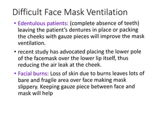 Difficult Face Mask Ventilation
 