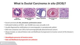 SABCS Highlight: COMET Study Results on Monitoring Low-Risk DCIS | PPT