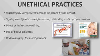 UNETHICAL PRACTICES
• Practicing by unregistered persons employed by the dentist.
• Signing a certificate issued for untrue, misleading and improper reasons.
• Direct or indirect advertising.
• Use of bogus diplomas.
• Undercharging for solicit patients.
 