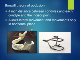 Bonwill ARTICULATORS | PPTX