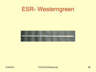 4/16/2014 Prof.Dr.R.R.Deshpande 304/16/2014 30
ESR- Westerngreen
 