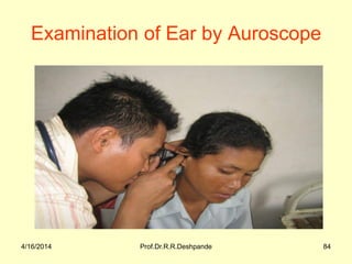4/16/2014 Prof.Dr.R.R.Deshpande 84
Examination of Ear by Auroscope
 