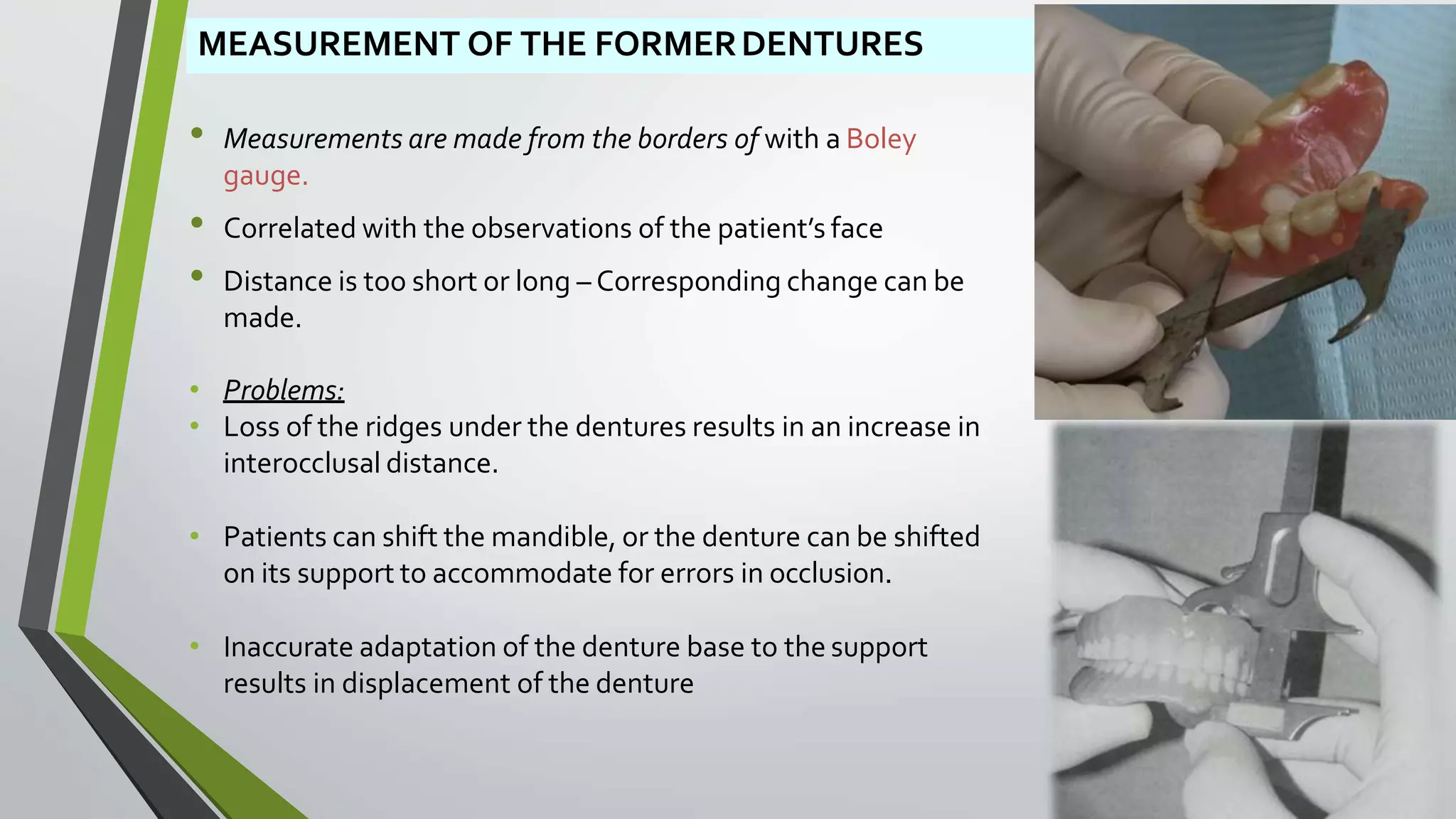 MEASUREMENT OF THE FORMERDENTURES
• Measurements are made from the borders of with a Boley
gauge.
• Correlated with the observations of the patient’s face
• Distance is too short or long – Corresponding change can be
made.
• Problems:
• Loss of the ridges under the dentures results in an increase in
interocclusal distance.
• Patients can shift the mandible, or the denture can be shifted
on its support to accommodate for errors in occlusion.
• Inaccurate adaptation of the denture base to the support
results in displacement of the denture
 