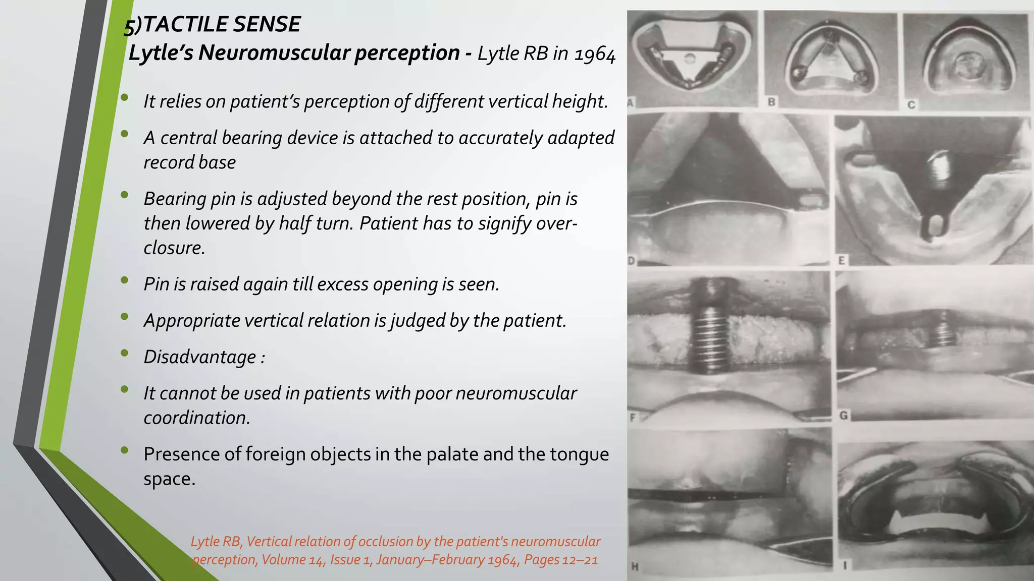 5)TACTILE SENSE
Lytle’s Neuromuscular perception - Lytle RB in 1964
43
• It relies on patient’s perception of different vertical height.
• A central bearing device is attached to accurately adapted
record base
• Bearing pin is adjusted beyond the rest position, pin is
then lowered by half turn. Patient has to signify over-
closure.
• Pin is raised again till excess opening is seen.
• Appropriate vertical relation is judged by the patient.
• Disadvantage :
• It cannot be used in patients with poor neuromuscular
coordination.
• Presence of foreign objects in the palate and the tongue
space.
Lytle RB,Vertical relation of occlusion by the patient's neuromuscular
perception,Volume 14, Issue 1,January–February 1964, Pages12–21
 