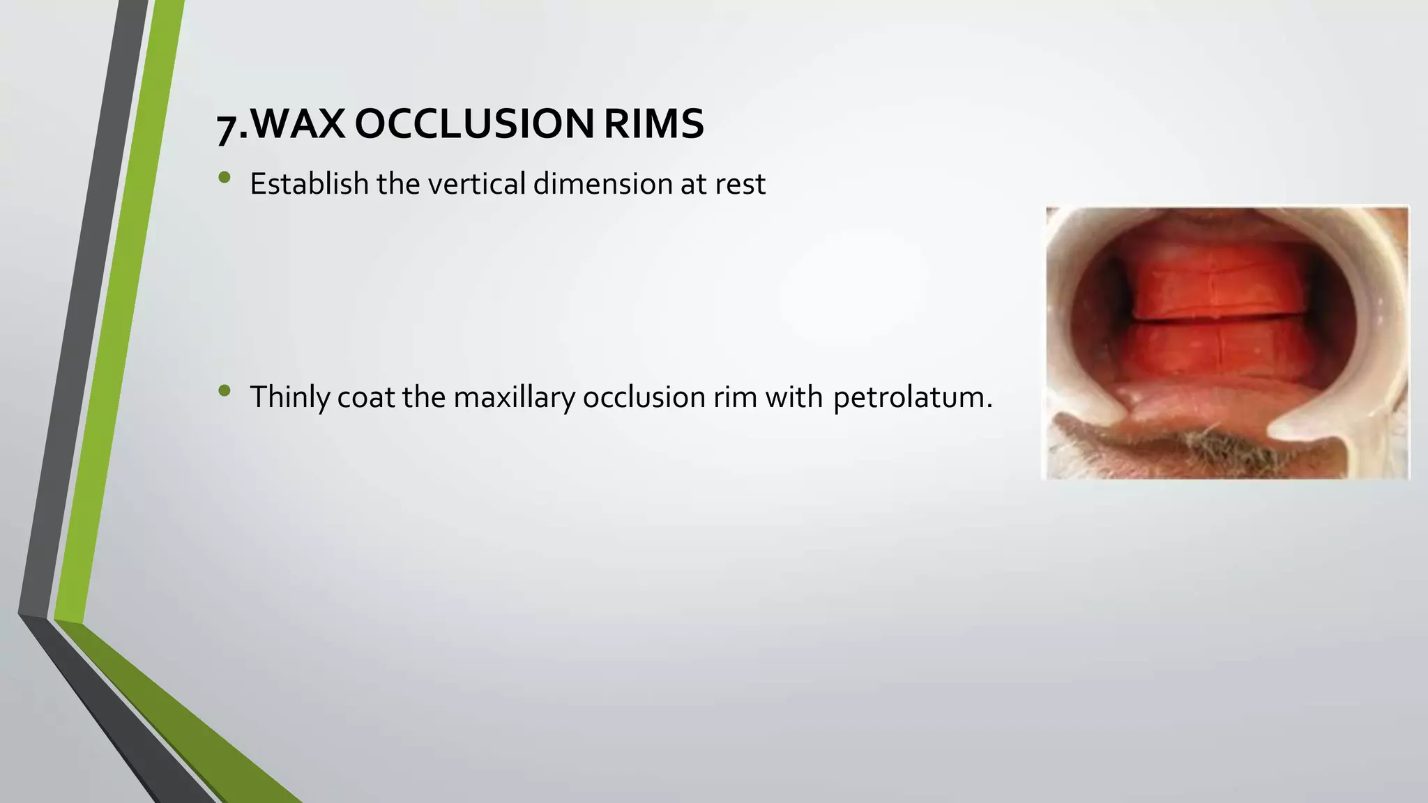 7.WAX OCCLUSIONRIMS
• Establish the vertical dimension at rest
• Thinly coat the maxillary occlusion rim with petrolatum.
 