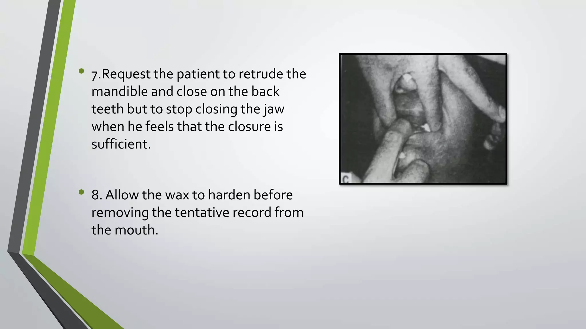 • 7.Request the patient to retrude the
mandible and close on the back
teeth but to stop closing the jaw
when he feels that the closure is
sufficient.
• 8. Allow the wax to harden before
removing the tentative record from
the mouth.
 
