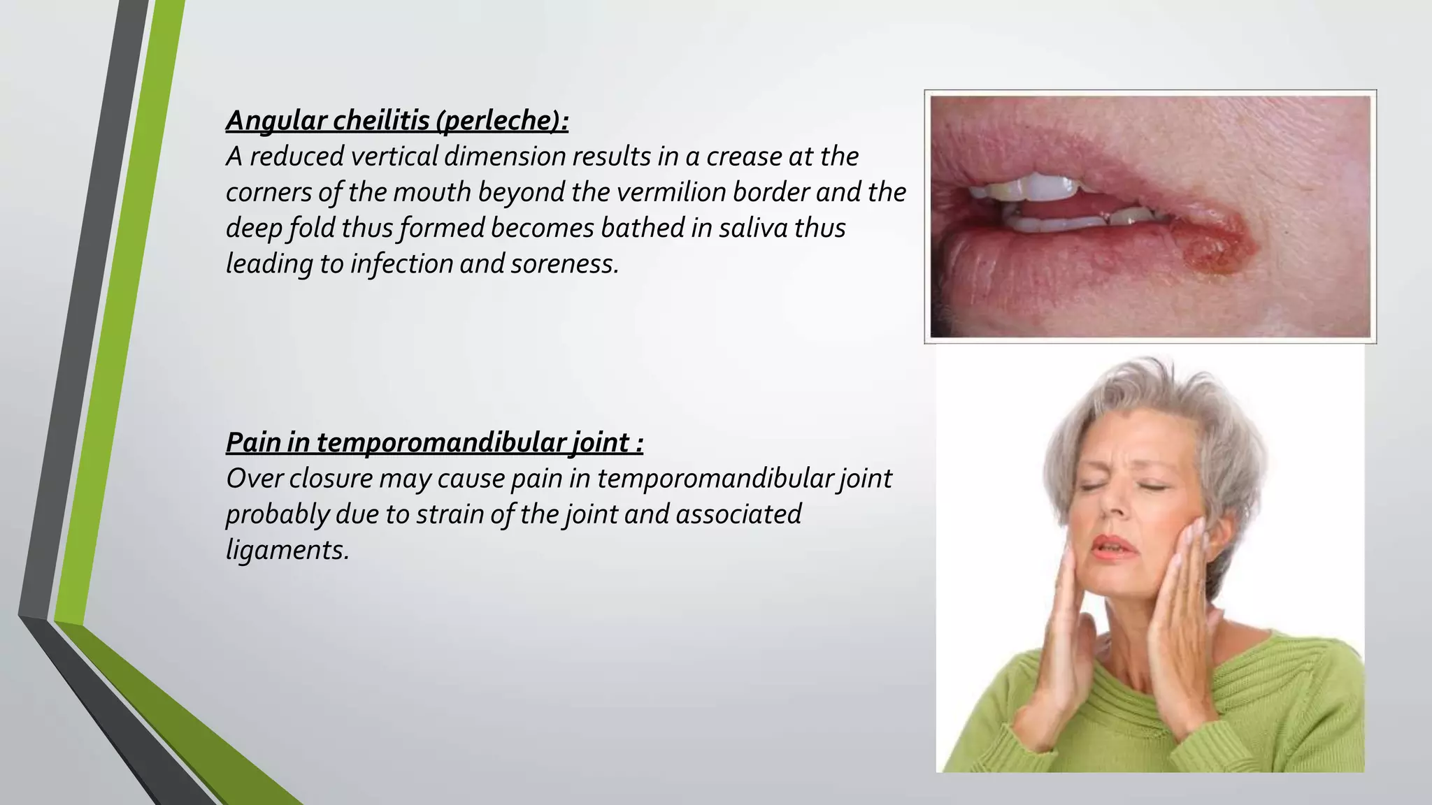 Angular cheilitis (perleche):
A reduced vertical dimension results in a crease at the
corners of the mouth beyond the vermilion border and the
deep fold thus formed becomes bathed in saliva thus
leading to infection and soreness.
Pain in temporomandibular joint :
Over closure may cause pain in temporomandibular joint
probably due to strain of the joint and associated
ligaments.
58
 