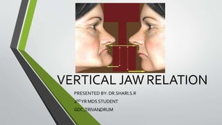 VERTICAL JAW RELATION
PRESENTED BY: DR.SHARI.S.R
2NDYR MDSSTUDENT
GDC ,TRIVANDRUM65
 