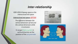 vertical jaw relation | PPTX