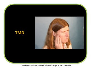 TMD
Functional Occlusion: From TMJ to Smile Design- PETER E DAWSON
 