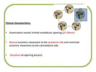 Clinical characteristics:
• Examination reveals limited mandibular opening (25-30mm).
• Normal eccentric movement to the ipsilateral side and restricted
eccentric movement to the contralateral side.
• Deviation on opening present.
 