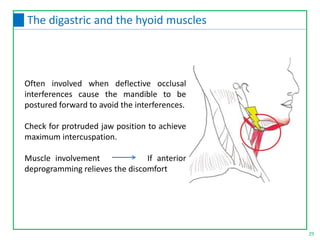 Often involved when deflective occlusal
interferences cause the mandible to be
postured forward to avoid the interferences.
Check for protruded jaw position to achieve
maximum intercuspation.
Muscle involvement If anterior
deprogramming relieves the discomfort
29
The digastric and the hyoid muscles
 