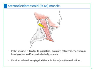 • If this muscle is tender to palpation, evaluate collateral effects from
head posture and/or cervical misalignments.
• Consider referral to a physical therapist for adjunctive evaluation.
30
Sternocleidomastoid (SCM) muscle.
 