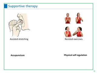 Assisted stretching Resisted exercises.
Accupuncture Physical self regulation
40
Supportive therapy
 