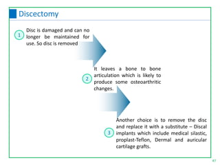 47
Discectomy
Disc is damaged and can no
longer be maintained for
use. So disc is removed
It leaves a bone to bone
articulation which is likely to
produce some osteoarthritic
changes.
Another choice is to remove the disc
and replace it with a substitute – Discal
implants which include medical silastic,
proplast-Teflon, Dermal and auricular
cartilage grafts.
1
2
3
 