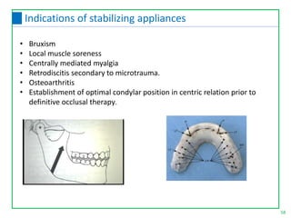 58
Indications of stabilizing appliances
• Bruxism
• Local muscle soreness
• Centrally mediated myalgia
• Retrodiscitis secondary to microtrauma.
• Osteoarthritis
• Establishment of optimal condylar position in centric relation prior to
definitive occlusal therapy.
 