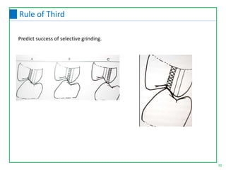 70
Rule of Third
Predict success of selective grinding.
 