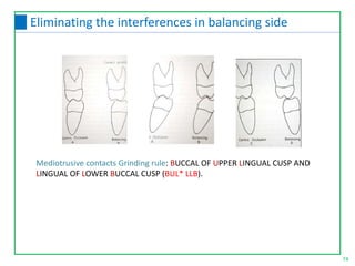 Mediotrusive contacts Grinding rule: BUCCAL OF UPPER LINGUAL CUSP AND
LINGUAL OF LOWER BUCCAL CUSP (BUL* LLB).
74
Eliminating the interferences in balancing side
 