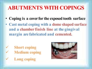 ABUTMENTS WITH COPINGS
• Coping is a coverfor the exposedtooth surface
• Cast metal coping with a dome shaped surface
and a chamberfinish line at the gingival
margin arefabricated and cemented.
 Short coping
 Medium coping
 Long coping
 
