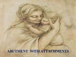 ABUTMENT WITH ATTACHMENTS
 