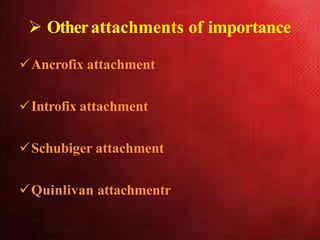  Otherattachments of importance
Ancrofix attachment
Introfix attachment
Schubiger attachment
Quinlivan attachmentr
 