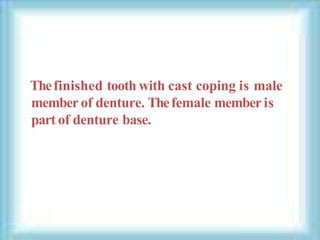 Thefinished tooth with cast coping is male
member of denture. Thefemale member is
part of denture base.
 