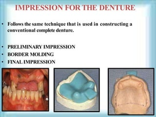 IMPRESSION FOR THE DENTURE
• Follows the same technique that is used in constructing a
conventional complete denture.
• PRELIMINARY IMPRESSION
• BORDER MOLDING
• FINALIMPRESSION
 