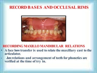 RECORDBASES AND OCCLUSAL RIMS
RECORDING MAXILLO MANDIBULAR RELATIONS
• A face bowtransfer is used to relate the maxillary cast to the
articulator.
• Jawrelations and arrangement of teeth for phonetics are
verified at the time of try in.
 