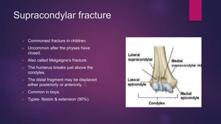 Supracondylar fracture
 Commonest fracture in children.
 Uncommon after the physes have
closed.
 Also called Malgaigne’s fracture.
 The humerus breaks just above the
condyles.
 The distal fragment may be displaced
either posteriorly or anteriorly.
 Common in boys.
 Types- flexion & extension (90%).
 