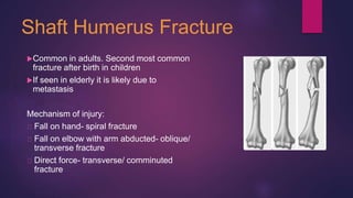 Shaft Humerus Fracture
Common in adults. Second most common
fracture after birth in children
If seen in elderly it is likely due to
metastasis
Mechanism of injury:
Fall on hand- spiral fracture
Fall on elbow with arm abducted- oblique/
transverse fracture
Direct force- transverse/ comminuted
fracture
 