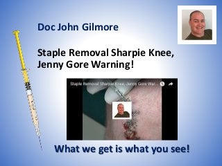 Staple Removal Sharpie Knee,
Jenny Gore Warning!
What we get is what you see!
Doc John Gilmore
 
