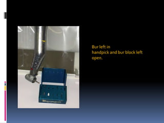 Bur left in
handpick and bur block left
open.
 