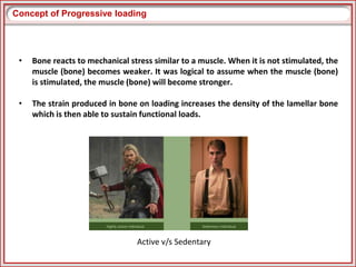 Progressive Loading Effect PROGRESSIVE LOADING IN IMPLANTS | PPTX