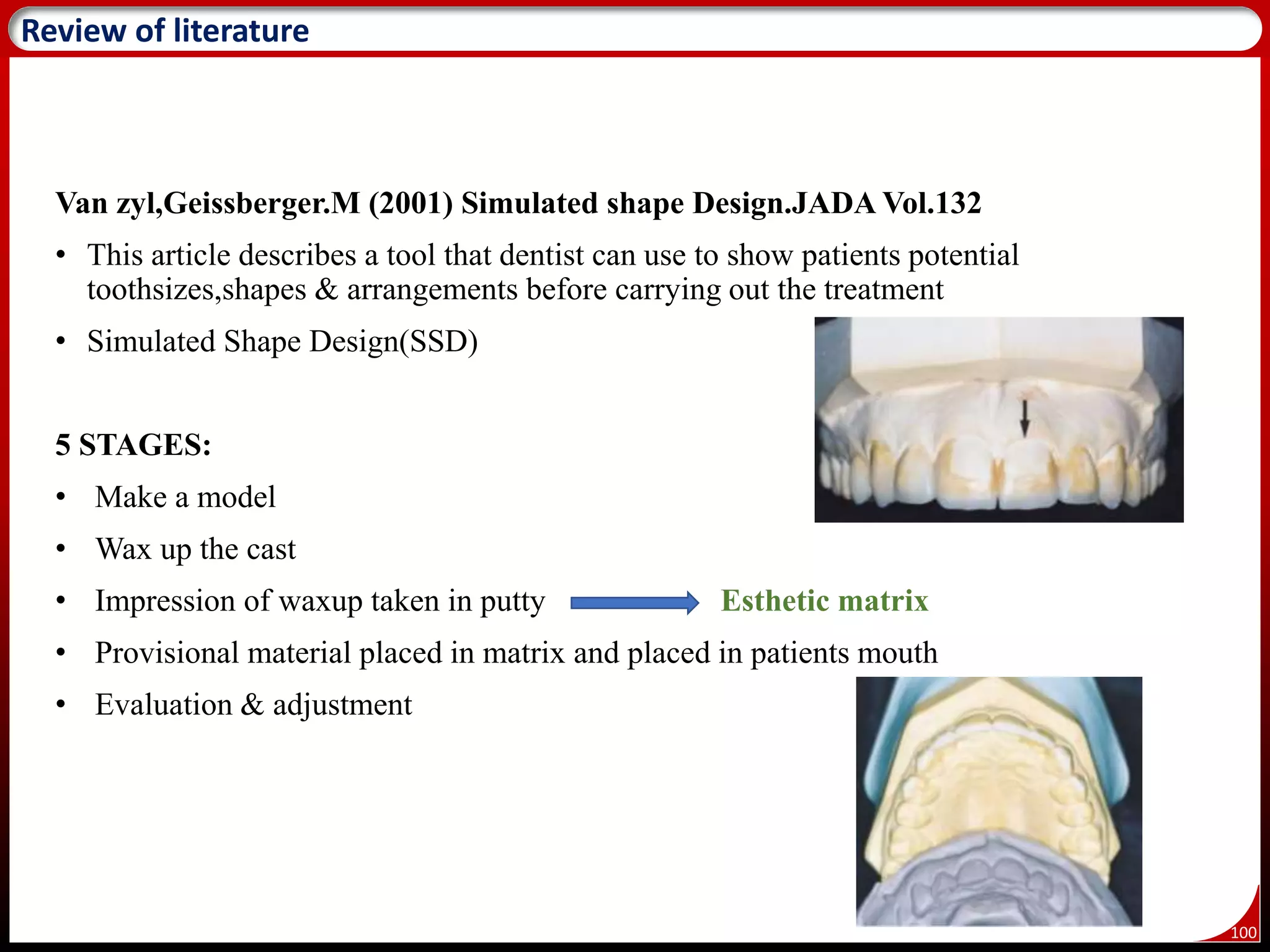 100
Review of literature
Van zyl,Geissberger.M (2001) Simulated shape Design.JADA Vol.132
• This article describes a tool that dentist can use to show patients potential
toothsizes,shapes & arrangements before carrying out the treatment
• Simulated Shape Design(SSD)
5 STAGES:
• Make a model
• Wax up the cast
• Impression of waxup taken in putty Esthetic matrix
• Provisional material placed in matrix and placed in patients mouth
• Evaluation & adjustment
 