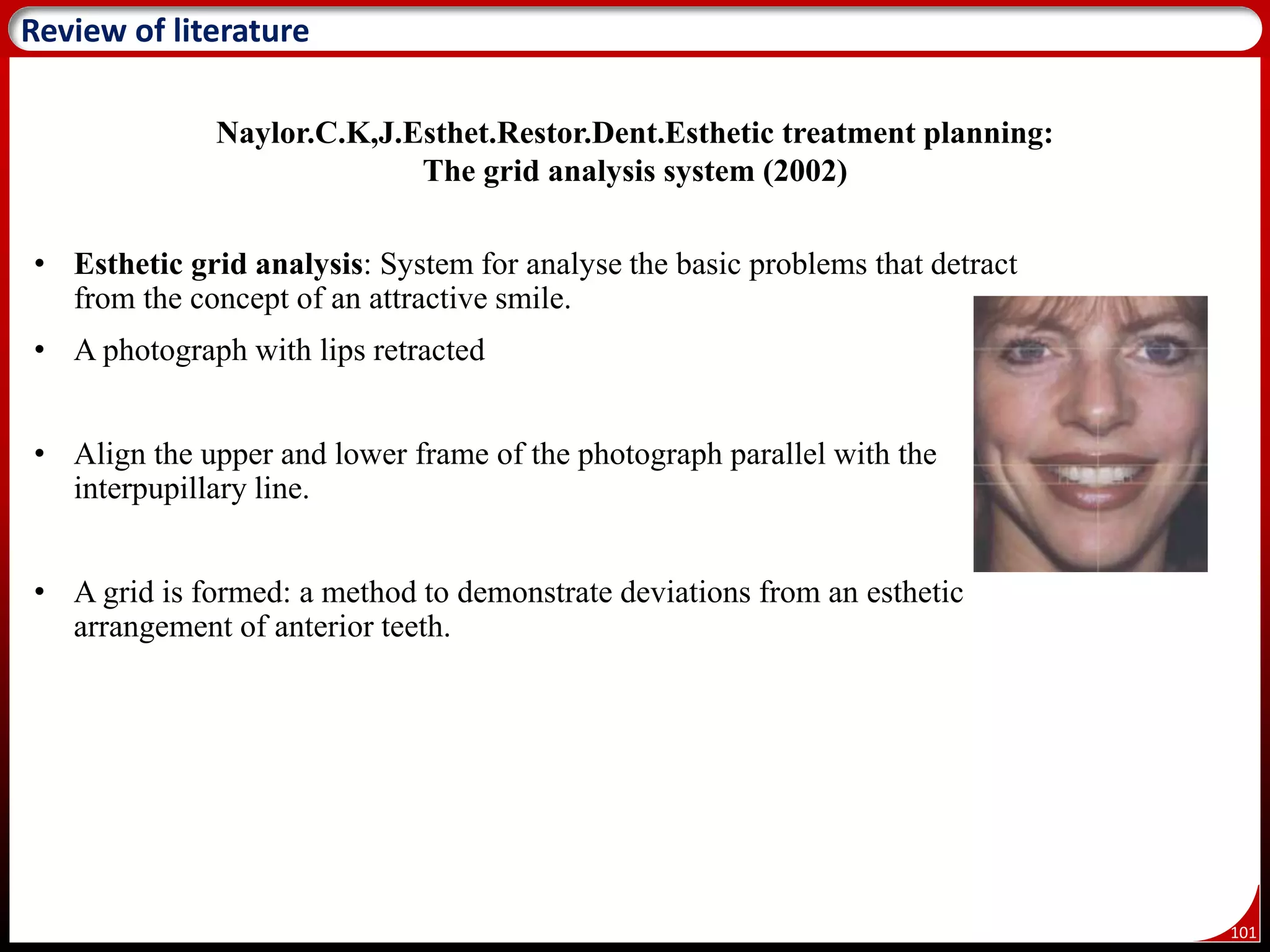 101
Review of literature
Naylor.C.K,J.Esthet.Restor.Dent.Esthetic treatment planning:
The grid analysis system (2002)
• Esthetic grid analysis: System for analyse the basic problems that detract
from the concept of an attractive smile.
• A photograph with lips retracted
• Align the upper and lower frame of the photograph parallel with the
interpupillary line.
• A grid is formed: a method to demonstrate deviations from an esthetic
arrangement of anterior teeth.
 