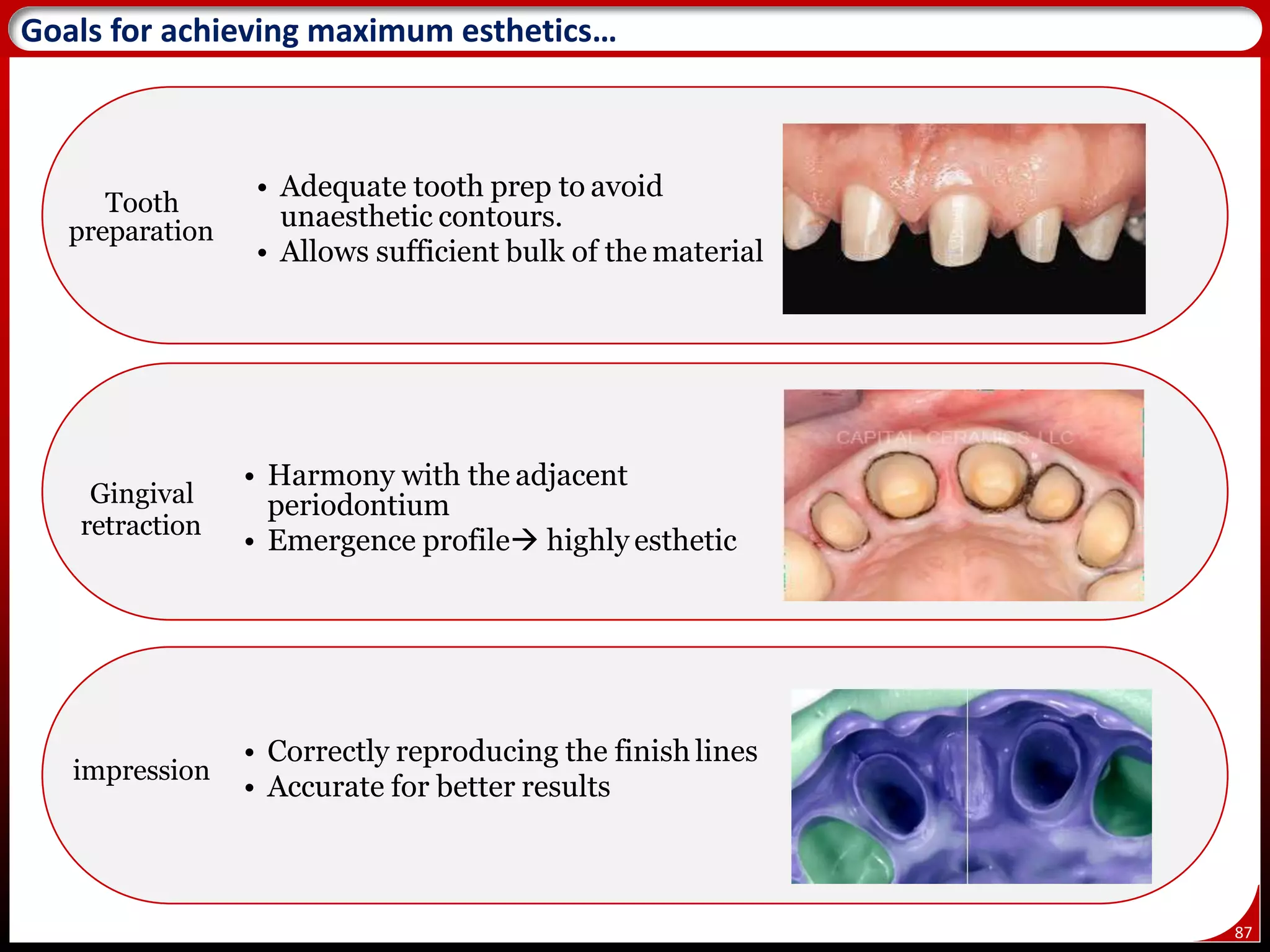 87
Goals for achieving maximum esthetics…
Tooth
preparation
• Adequate tooth prep to avoid
unaesthetic contours.
• Allows sufficient bulk of the material
Gingival
retraction
• Harmony with the adjacent
periodontium
• Emergence profile highly esthetic
impression
• Correctly reproducing the finish lines
• Accurate for better results
 