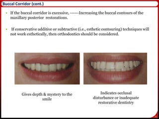 33
 If the buccal corridor is excessive, ------Increasing the buccal contours of the
maxillary posterior restorations.
 If conservative additive or subtractive (i.e., esthetic contouring) techniques will
not work esthetically, then orthodontics should be considered.
Gives depth & mystery to the
smile
Indicates occlusal
disturbance or inadequate
restorative dentistry
34
Buccal Corridor (cont.)
 