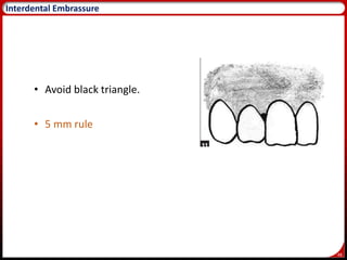 48
Interdental Embrassure
• Avoid black triangle.
• 5 mm rule
 