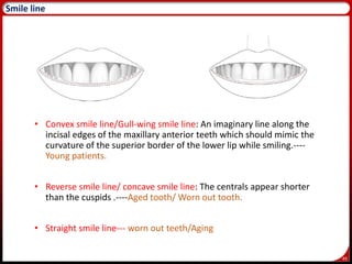 49
Smile line
• Convex smile line/Gull-wing smile line: An imaginary line along the
incisal edges of the maxillary anterior teeth which should mimic the
curvature of the superior border of the lower lip while smiling.----
Young patients.
• Reverse smile line/ concave smile line: The centrals appear shorter
than the cuspids .----Aged tooth/ Worn out tooth.
• Straight smile line--- worn out teeth/Aging
 