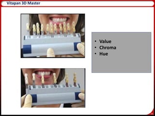 58
Vitapan 3D Master
• Value
• Chroma
• Hue
 